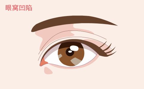 打造無痕肌膚，選擇激光祛痘印就是關(guān)鍵！